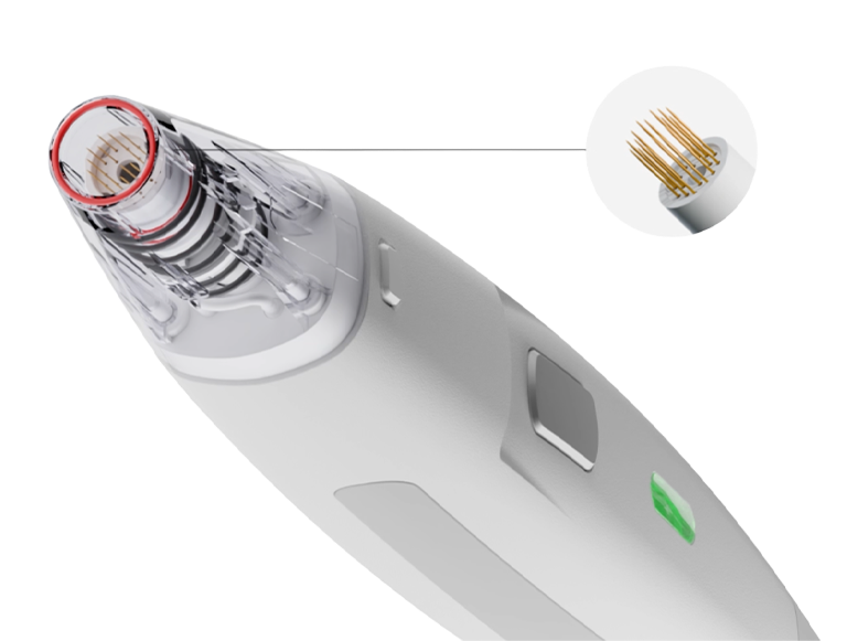 SSCM (Blow Tip)